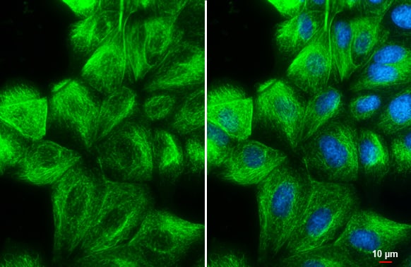 Immunocytochemistry/ Immunofluorescence: Vimentin Antibody [NBP1-31327] - Vimentin antibody detects Vimentin protein at cytoskeleton by immunofluorescent analysis.Sample: MDCK cells were fixed in 4% paraformaldehyde at RT for 15 min.Green: Vimentin stained by Vimentin antibody (NBP1-31327) diluted at 1:500.Blue: Hoechst 33342 staining.Scale bar= 10 um.