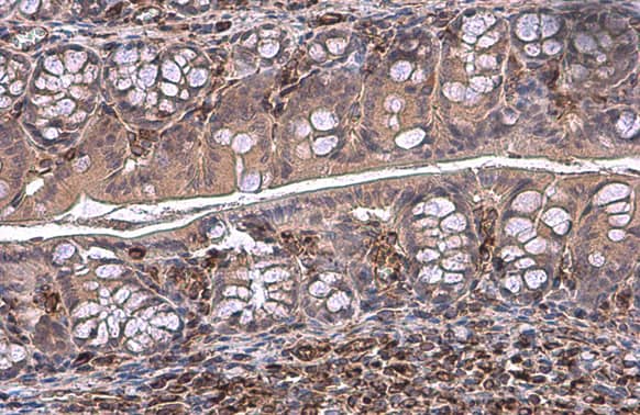 Immunohistochemistry-Paraffin: Vimentin Antibody [NBP1-31327] - Vimentin antibody detects Vimentin protein at cytoplasm by immunohistochemical analysis.Sample: Paraffin-embedded mouse colon.Vimentin stained by Vimentin antibody (NBP1-31327) diluted at 1:500.Antigen Retrieval: Citrate buffer, pH 6.0, 15 min