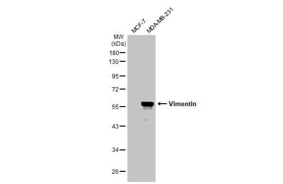 Western Blot: Vimentin Antibody [NBP1-31327] - Various whole cell extracts (30 ug) were separated by 10% SDS-PAGE, and the membrane was blotted with Vimentin antibody (NBP1-31327) diluted at 1:5000. The HRP-conjugated anti-rabbit IgG antibody  was used to detect the primary antibody.