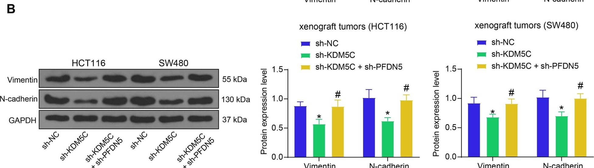 KDM5C/PFDN5 affects EMT in CRC. A protein levels of Vimentin and N-cadherin in HCT116 and SW480 cells determined by WB analysis (two-way ANOVA); B protein levels of Vimentin and N-cadherin in xenograft tumors determined by western blot analysis (two-way ANOVA). For cellular experiments, three biological replicates were performed. For animal studies, n = 5 in each group. *p < 0.05 vs. the sh-NC group; #p < 0.05 vs. the sh-KDM5C group Image collected and cropped by CiteAb from the following open publication (//molmed.biomedcentral.com/articles/10.1186/s10020-023-00775-7), licensed under a CC-BY license. Not internally tested by Novus Biologicals.