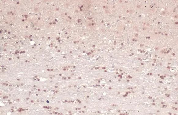 Immunohistochemistry-Paraffin: Acetylcholinesterase/ACHE Antibody [NBP1-31329] - Acetylcholinesterase/ACHE antibody detects Acetylcholinesterase/ACHE protein at nucleus by immunohistochemical analysis.Sample: Paraffin-embedded rat brain.Acetylcholinesterase/ACHE stained by Acetylcholinesterase/ACHE antibody (NBP1-31329) diluted at 1:500.Antigen Retrieval: Citrate buffer, pH 6.0, 15 min