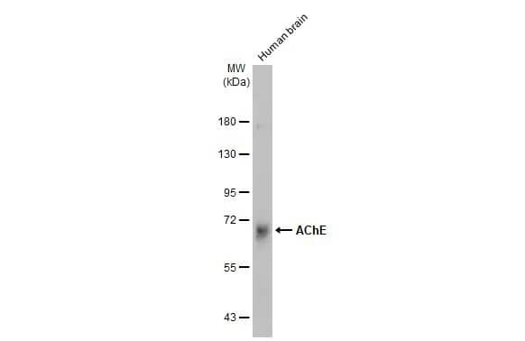 Western Blot: Acetylcholinesterase/ACHE Antibody [NBP1-31329] - Human tissue extract (30 ug) was separated by 7.5% SDS-PAGE, and the membrane was blotted with Acetylcholinesterase/ACHE antibody (NBP1-31329) diluted at 1:500. The HRP-conjugated anti-rabbit IgG antibody  was used to detect the primary antibody.