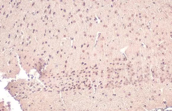 Immunohistochemistry-Paraffin: Acetylcholinesterase/ACHE Antibody [NBP1-31329] - Acetylcholinesterase/ACHE antibody detects Acetylcholinesterase/ACHE protein at nucleus by immunohistochemical analysis.Sample: Paraffin-embedded mouse brain.Acetylcholinesterase/ACHE stained by Acetylcholinesterase/ACHE antibody (NBP1-31329) diluted at 1:500.Antigen Retrieval: Citrate buffer, pH 6.0, 15 min