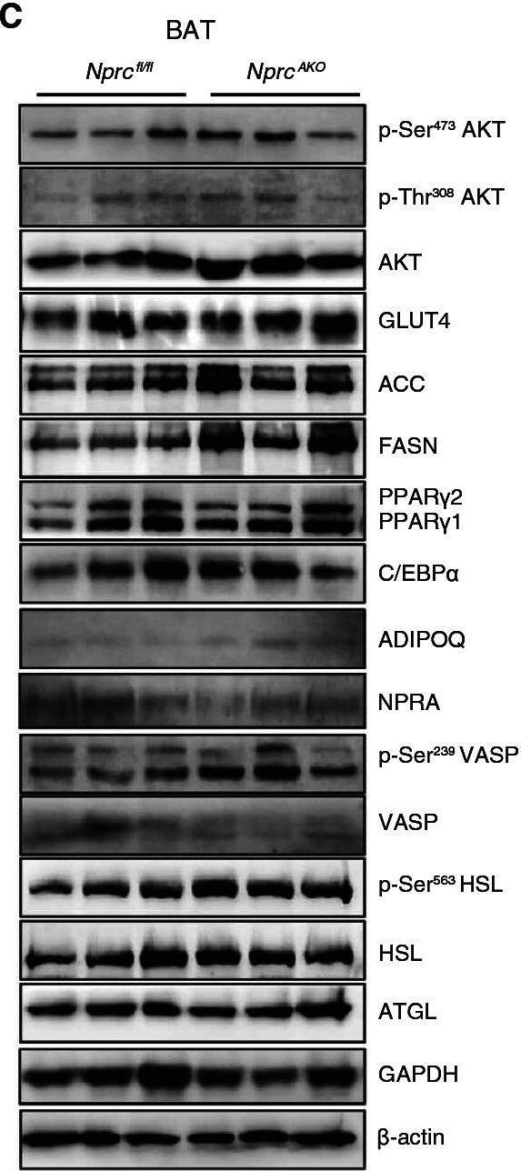 Western Blot NPRA/NPR1 Antibody - BSA Free