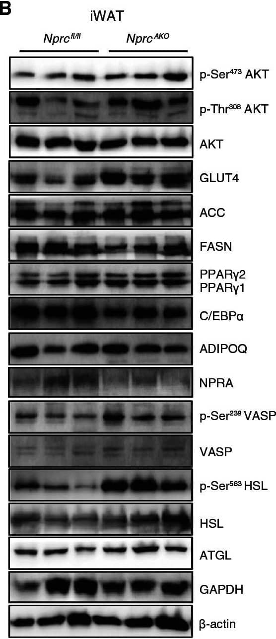 Western Blot NPRA/NPR1 Antibody - BSA Free