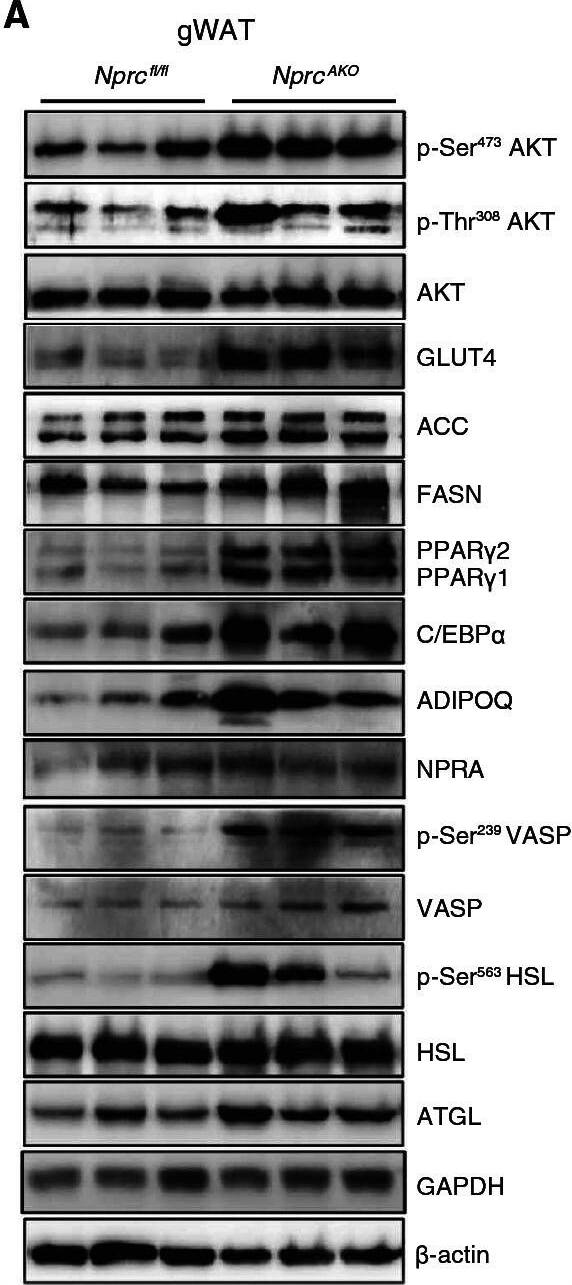 Insulin signaling, de novo lipogenesis, adipogenesis, lipolysis, and PKG activity in adipose tissues of HFD-fed NprcAKO mice.(A to C) Western blotting analysis for proteins involved in insulin signaling (p-Ser473 AKT, p-Thr308 AKT, and GLUT4), de novo lipogenesis (ACC and FASN), adipogenesis (PPAR gamma , C/EBP alpha , and ADIPOQ), PKG activity (p-Ser239 VASP), and lipolysis (p-Ser563 HSL and ATGL) performed on lysates from gWAT (A), iWAT (B), and BAT (C) of NprcAKO and Nprcfl/fl mice after 12 weeks on HFD. p, phosphorylated. Blots are representative of three independent experiments. Image collected and cropped by CiteAb from the following open publication (//pubmed.ncbi.nlm.nih.gov/28743802), licensed under a CC-BY license. Not internally tested by Novus Biologicals.