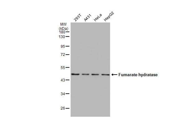 Western Blot Fumarase Antibody - BSA Free