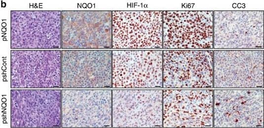 Immunohistochemistry: NQO-1 Antibody [NBP1-31355] - NQO1 promotesin vivo tumour growth.(a) RKO/pNQO1, RKO/shCont & RKO/pshNQO1 cells injected subcutaneously into right flank of athymic, 7-week-old female BALB/C nude mice, & tumour growth assessed. Tumour volume (TV) calculated by using following formula: TV=length × (width)2 × 0.5. Each group contained 12 animals. (**P<0.01 w/ unpaired t-test). (b) Immunohistochemical analyses of RKO/pNQO1, RKO/shCont, & RKO/pshNQO1 xenograft tumours. The sections stained for NQO1, HIF-1 alpha , proliferation (Ki67) & apoptosis (CC3) using 3,3′-DAB. Scale bar, 50 μm. (c) Quantification of NQO1, proliferative marker Ki67 & apoptotic marker CC3 in RKO/pNQO1, RKO/shCont & RKO/pshNQO1 xenograft tumours (n=3 each group). n=5 in each tumour. Two-tail t-test. **P<0.01, *P<0.05. #, not significant. All error bars represent mean±s.e.m. (d) RKO/pshCont1/pshCont2, RKO/pNQO1/pshCont2 & RKO/pNQO1/pshHIF-1 alpha  injected subcutaneously into right flank of athymic, 7-week-old female BALB/C nude mice, & tumour growth assessed. Tumour volume (TV) calculated by using following formula: TV=length × (width)2 × 0.5. Each group contained 10 animals (*P<0.05 w/ unpaired t-test). (e) Immunohistochemical analyses of RKO/pshCont1/pshCont2, RKO/pNQO1/pshCont2 & RKO/pNQO1/pshHIF-1 alpha  xenograft tumours for HIF-1 alpha , proliferation (Ki67), apoptosis (CC3) & vasculature (CD34) using 3,3′-DAB. Arrowheads denote blood vessels. Scale bar, 50 μm. (f) RKO/pNQO1/pshCont or RKO/pNQO1/pshHIF-1 alpha  xenograft tumours (n=3–5 each group) quantified for proliferation (Ki67), apoptosis (CC3) & vascularization (CD34). n=5 in each tumour. Two tailed t-test. **P<0.01, *P<0.05. #, not significant. All error bars represent mean±s.e.m. (g) Schematic model showing how NQO1 stabilizes HIF-1 alpha  in cancer cells. Image collected & cropped by CiteAb from following publication (//pubmed.ncbi.nlm.nih.gov/27966538), licensed under a CC-BY license. Not internally tested by Novus Biologicals.