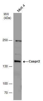 Western Blot: Caspr2 Antibody [NBP1-31358] - Caspr2 antibody detects Caspr2 protein by Western blot analysis. Whole cell extracts (30 ug) was separated by 5 % SDS-PAGE, and blotted with Caspr2 antibody (NBP1-31358) diluted by 1:5000