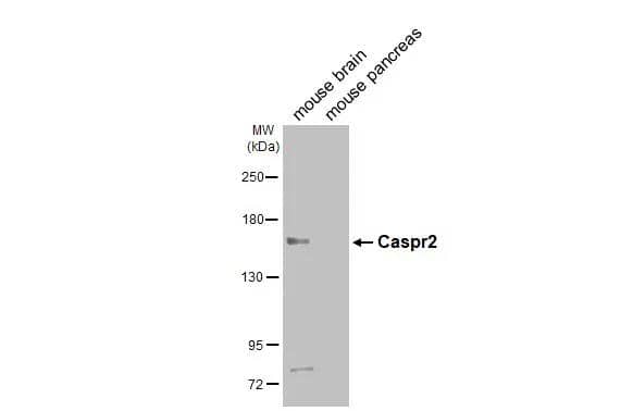 Western Blot Caspr2 Antibody - BSA Free