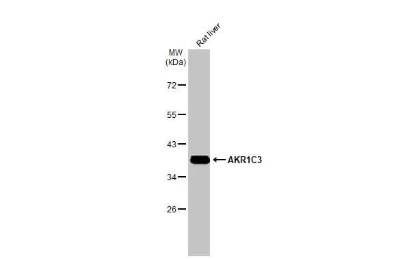 Rat tissue extract (50 ug) was separated by 10% SDS-PAGE, and the membrane was blotted with Aldo-keto Reductase 1C3/AKR1C3 antibody [C2C3], C-term (NBP1-31378) diluted at 1:2000. The HRP-conjugated anti-rabbit IgG antibody was used to detect the primary antibody. 