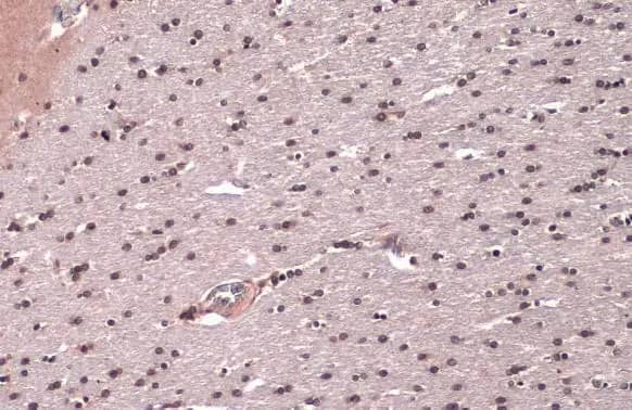 Immunohistochemistry-Paraffin: NUP62 Antibody [NBP1-31381] - NUP62 antibody detects NUP62 protein at nucleus by immunohistochemical analysis.Sample: Paraffin-embedded rat brain.NUP62 stained by NUP62 antibody (NBP1-31381) diluted at 1:500.Antigen Retrieval: Citrate buffer, pH 6.0, 15 min