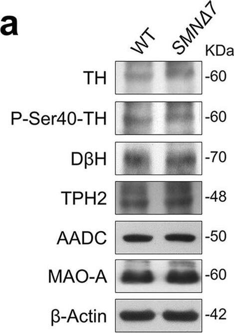 Expression levels of monoamine-regulating enzymes in the brain of SMN delta 7 mice.a, h, o Representative autoradiograms of brain lysates immunoblots of SMN delta 7 and wild-type (WT) mice at a post-natal day 3, h day 6, and o day 11. b–g Protein levels quantification of b Tyrosine hydroxylase (TH), c phospho-Tyrosine hydroxylase at Ser-40 (P-Ser40-TH), d Dopamine  beta  hydroxylase (D beta H), e Tryptophan hydroxylase 2 (TPH2), f Aromatic amino acid decarboxylase (AADC) and g Monoamine Oxidase A (MAO-A) in SMN delta 7 (n = 4) and WT (n = 5) mice (except for TPH2: n = 4 mice/genotype) at post-natal day 3. i–n Protein levels quantification of i TH (n = 4 WT, n = 5 SMN delta 7), j P-Ser40-TH (n = 4 WT, n = 5 SMN delta 7), k D beta H (n = 4 WT, n = 4 SMN delta 7), l TPH2 (n = 4 WT, n = 3 SMN delta 7), m AADC (n = 4 WT, n = 5 SMN delta 7) and n MAO-A (n = 4 WT, n = 5 SMN delta 7) at post-natal day 6. p–u Protein levels quantification of p TH (n = 13 WT, n = 14 SMN delta 7), q P-Ser40-TH (n = 4 WT, n = 5 SMN delta 7), r D beta H (n = 4 WT, n = 5 SMN delta 7), s TPH2 (n = 4 WT, n = 5 SMN delta 7), t AADC (n = 13 WT, n = 14 SMN delta 7) and u MAO-A (n = 8 WT, n = 10 SMN delta 7) at post-natal day 11. Data are normalized to  beta -Actin levels and shown as box and whisker plots representing the median with interquartile range (IQR). Dots represent individual mice values. *p < 0.05, **p < 0.01, compared with age-matched WT mice (unpaired t-test). Image collected and cropped by CiteAb from the following open publication (//pubmed.ncbi.nlm.nih.gov/37957344), licensed under a CC-BY license. Not internally tested by Novus Biologicals.