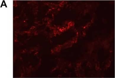 Immunocytochemistry/ Immunofluorescence: CXCL14/BRAK Antibody [NBP1-31398] - Two-color immunofluorescence staining of primary colon cancer tissue with anti-CXCL14 & BerEP4, & anti-CXCL16 & BerEP4. (A) Anti-CXCL14, (E) Anti-CXCL16 both red color. (B,F) BerEP4 mAb, green color. (C,G) Overlays giving yellow color of double-stained areas. (D) FITC-conjugated mouse IgG; negative control for BerEP4. (H) Rabbit IgG; negative control for anti-CXCL14 & anti-CXCL16. Original magnification: ×200. Image collected & cropped by CiteAb from the following publication (//pubmed.ncbi.nlm.nih.gov/31752131), licensed under a CC-BY license. Not internally tested by Novus Biologicals.