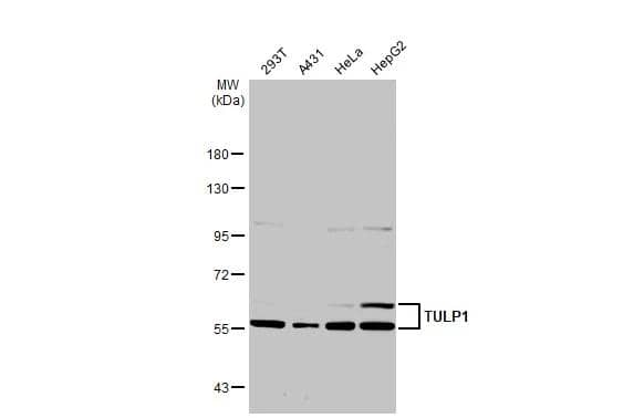 Western Blot TULP1 Antibody - BSA Free