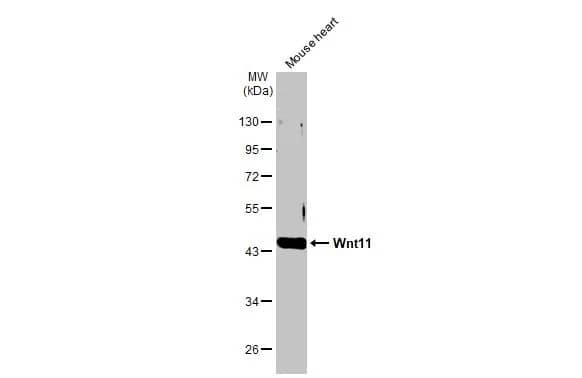 Western Blot: Wnt-11 Antibody [NBP1-31406] - Mouse tissue extract (50 ug) was separated by 10% SDS-PAGE, and the membrane was blotted with Wnt-11 antibody (NBP1-31406) diluted at 1:1000. The HRP-conjugated anti-rabbit IgG antibody  was used to detect the primary antibody.