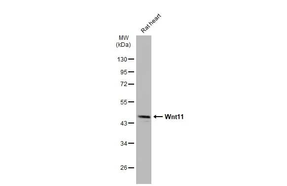 Western Blot: Wnt-11 Antibody [NBP1-31406] - Rat tissue extract (50 ug) was separated by 10% SDS-PAGE, and the membrane was blotted with Wnt-11 antibody (NBP1-31406) diluted at 1:5000. The HRP-conjugated anti-rabbit IgG antibody  was used to detect the primary antibody, and the signal was developed with Trident ECL plus-Enhanced.