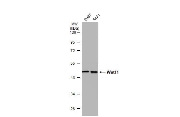 Western Blot: Wnt-11 Antibody [NBP1-31406] - Various whole cell extracts (30 ug) were separated by 10% SDS-PAGE, and the membrane was blotted with Wnt-11 antibody (NBP1-31406) diluted at 1:1000. The HRP-conjugated anti-rabbit IgG antibody  was used to detect the primary antibody.