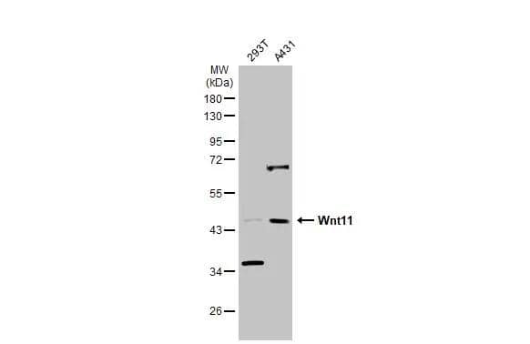 Various whole cell extracts (30 ug) were separated by 10% SDS-PAGE, and the membrane was blotted with Wnt-11 antibody (NBP1-31406) diluted at 1:1000. The HRP-conjugated anti-rabbit IgG antibody was used to detect the primary antibody. 