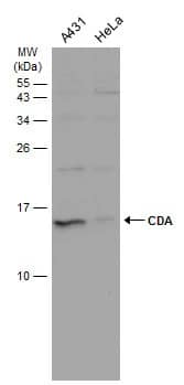 Western Blot: Citidine Deaminase Antibody [NBP1-31412] - Various whole cell extracts (30 ug) were separated by 15% SDS-PAGE, and the membrane was blotted with Citidine Deaminase antibody (NBP1-31412) diluted at 1:1000. The HRP-conjugated anti-rabbit IgG antibody  was used to detect the primary antibody.