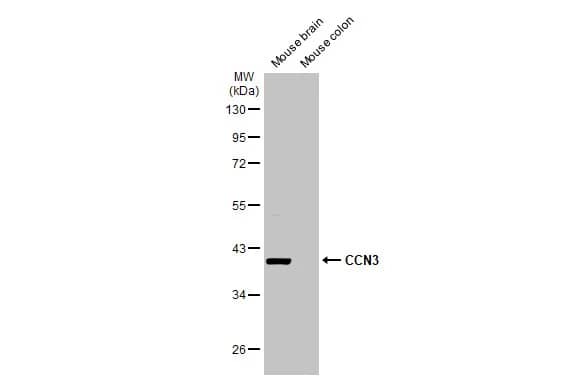 Western Blot: NOV/CCN3 Antibody [NBP1-31416] - Various tissue extracts (50 ug) were separated by 10% SDS-PAGE, and the membrane was blotted with NOV/CCN3 antibody (NBP1-31416) diluted at 1:1000. The HRP-conjugated anti-rabbit IgG antibody  was used to detect the primary antibody.