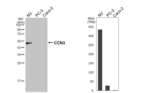 <b>Orthogonal Strategies Validation. </b>Various whole cell extracts (30 ug) were separated by 12% SDS-PAGE, and the membrane was blotted with NOV/CCN3 antibody (NBP1-31416) diluted at 1:1000. The HRP-conjugated anti-rabbit IgG antibody was used to detect the primary antibody. Corresponding RNA expression data for the same cell lines are based on Human Protein Atlas program. 