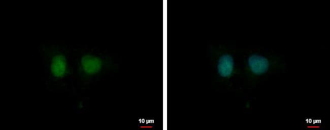 Immunocytochemistry/ Immunofluorescence DDI1 Antibody - BSA Free