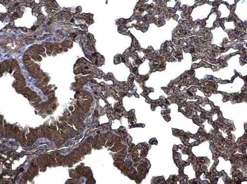 Immunohistochemistry: CLIC3 Antibody [NBP1-31438] - CLIC3 antibody [N1C3] detects CLIC3 protein at membrane and cytoplasm on mouse lung by immunohistochemical analysis. Sample: Paraffin-embedded mouse lung. CLIC3 antibody [N1C3] (NBP1-31438) diluted at 1:500.Antigen Retrieval: Trilogy™ (EDTA based, pH 8.0) buffer, 15min