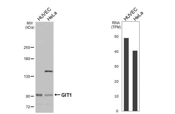 Western Blot GIT1 Antibody - BSA Free