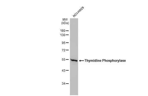 Western Blot: PD-ECGF/Thymidine Phosphorylase Antibody [NBP1-31458] - Whole cell extract (30 ug) was separated by 10% SDS-PAGE, and the membrane was blotted with PD-ECGF/Thymidine Phosphorylase antibody (NBP1-31458) diluted at 1:1000. The HRP-conjugated anti-rabbit IgG antibody  was used to detect the primary antibody.