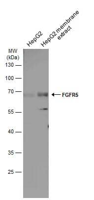 HepG2 whole cell and membrane extracts (30 ug) were separated by 10% SDS-PAGE, and the membrane was blotted with FGFR5/FGFRL1 antibody (NBP1-31461) diluted at 1:1000. The HRP-conjugated anti-rabbit IgG antibody was used to detect the primary antibody. 