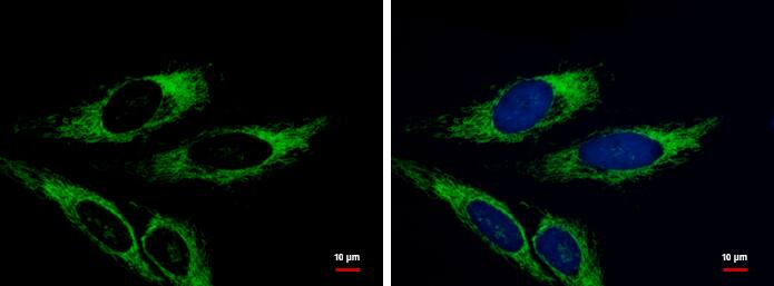 Immunocytochemistry/ Immunofluorescence: AK3L1 Antibody [NBP1-31462] - AK3L1 antibody [N1C3] detects AK3L1 protein at mitochondria by immunofluorescent analysis.Sample: HeLa cells were fixed in 2% paraformaldehyde/culture medium at 37ºC for 30 min.Green: AK3L1 protein stained by AK3L1 antibody [N1C3] (NBP1-31462) diluted at 1:500.Blue: Hoechst 33342 staining.