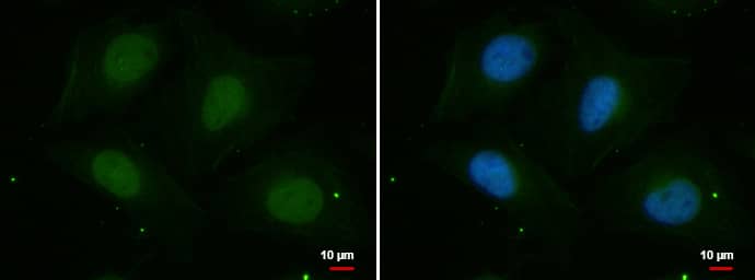 Immunocytochemistry/ Immunofluorescence: PSKH2 Antibody [NBP1-31467] - PSKH2 antibody [N2C3] detects PSKH2 protein at nucleus by immunofluorescent analysis.Sample: HeLa cells were fixed in 4% paraformaldehyde at RT for 15 min.Green: PSKH2 protein stained by PSKH2 antibody [N2C3] (NBP1-31467) diluted at 1:100.Blue: Hoechst 33342 staining.