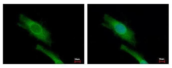 DAP5 antibody detects EIF4G2 protein at cytoplasm by immunofluorescent analysis. Sample: HeLa cells were fixed in ice-cold MeOH for 5 min.Green: EIF4G2 protein stained by DAP5 antibody (NBP1-31469) diluted at 1:500.Blue: Hoechst 33343 staining. 