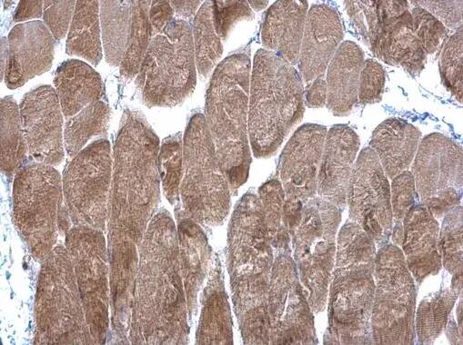 Immunohistochemistry: DPP3 Antibody [NBP1-31476] - DPP3 antibody [N2C1], Internal detects DPP3 protein at cytoplasm on mouse muscle by immunohistochemical analysis. Sample: Paraffin-embedded mouse muscle. DPP3 antibody [N2C1], Internal (NBP1-31476) diluted at 1:500.Antigen Retrieval: Trilogy™ (EDTA based, pH 8.0) buffer, 15min