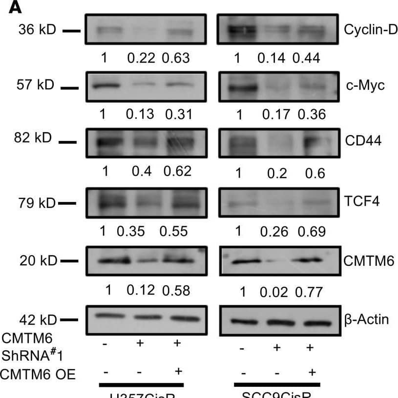 CMTM6 regulates Wnt signaling via the ENO-1/AKT/GSK3 beta / beta -catenin axis.(A) CMTM6 was overexpressed in chemoresistant cells stably expressing NTShRNA or CMTM6ShRNA#2, and immunoblotting (n = 3) was performed with indicated antibodies. (B) Lysates were isolated from cisplatin-resistant lines stably transfected with NtSh and ENO1Sh and subjected to immunoblotting (n = 3) for indicated antibodies. (C) Myr AKT (constitutively active AKT) was overexpressed in chemoresistant cells stably expressing NTShRNA or CMTM6ShRNA#2, and immunoblotting (n = 3) was performed with indicated antibodies. (D) Lysates were isolated from LY294002-treated cells and vehicle control, and immunoblotting (n = 3) was performed using indicated antibodies. (E) mRNA was isolated from LY294002-treated cells and vehicle control, and relative mRNA (fold change) expression (n = 3) of indicated genes was analyzed by qRT-PCR in the indicated cell. Two-way ANOVA. (F) IHC of  beta -catenin and target genes in tumor of PDX model. Scale bar: 50 μm. Image collected and cropped by CiteAb from the following open publication (//pubmed.ncbi.nlm.nih.gov/33434185), licensed under a CC-BY license. Not internally tested by Novus Biologicals.