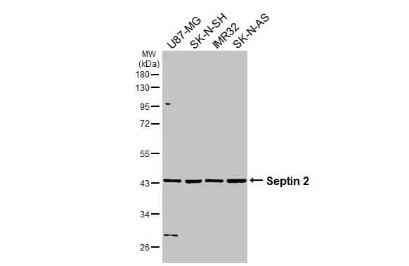 Various whole cell extracts (30 ug) were separated by 10% SDS-PAGE, and the membrane was blotted with Septin-2 antibody [N1N3] (NBP1-31496) diluted at 1:2000. The HRP-conjugated anti-rabbit IgG antibody was used to detect the primary antibody. 