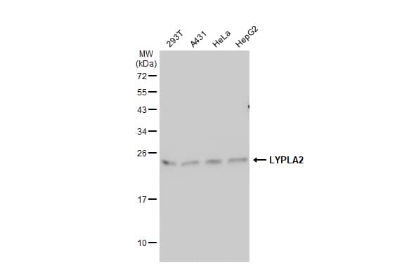 <b>Genetic Strategies Validation. </b>Western Blot: LYPLA2 Antibody [NBP1-31538] - Various whole cell extracts (30 ug) were separated by 12% SDS-PAGE, and the membrane was blotted with LYPLA2 antibody [N1C3] (NBP1-31538) diluted at 1:1000. The HRP-conjugated anti-rabbit IgG antibody  was used to detect the primary antibody.