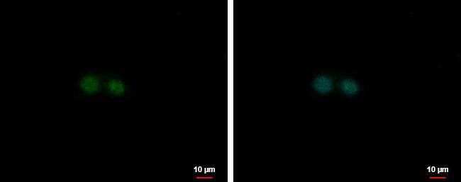 Nuclear Factor Erythroid Derived 2 antibody [N1C3] detects Nuclear Factor Erythroid Derived 2 protein at nucleus by immunofluorescent analysis.Sample: HepG2 cells were fixed in 4% paraformaldehyde at RT for 15 min.Green: Nuclear Factor Erythroid Derived 2 protein stained by Nuclear Factor Erythroid Derived 2 antibody [N1C3] (NBP1-31540) diluted at 1:500.Blue: Hoechst 33342 staining.Scale bar = 10 um. 