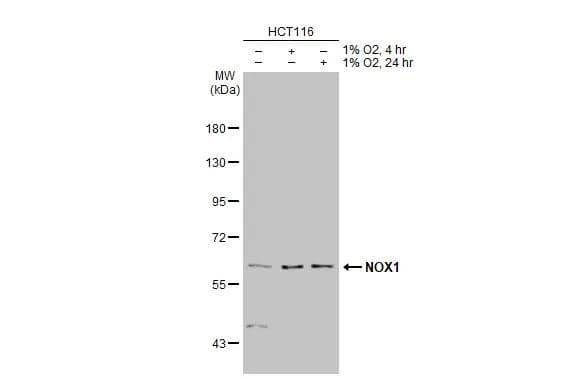 <b>Orthogonal Strategies Validation. </b>Untreated (-) and treated (+) HCT116 whole cell extracts (30 ug) were separated by 7.5% SDS-PAGE, and the membrane was blotted with NOX1 antibody (NBP1-31546) diluted at 1:2000. The HRP-conjugated anti-rabbit IgG antibody was used to detect the primary antibody. 