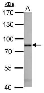 Radixin antibody detects RDX protein by Western blot analysis.A. 50 ug mouse liver lysate/extract7.5 % SDS-PAGERadixin antibody (NBP1-31553) dilution: 1:1000 