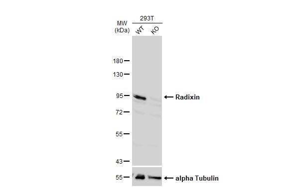 <b>Genetic Strategies Validation. </b>Wild-type (WT) and Radixin knockout (KO) 293T cell extracts (30 ug) were separated by 7.5% SDS-PAGE, and the membrane was blotted with Radixin antibody (NBP1-31553) diluted at 1:1000. The HRP-conjugated anti-rabbit IgG antibody was used to detect the primary antibody. 