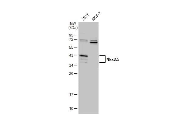 Western Blot: NKX2.5 Antibody [NBP1-31558] - Various whole cell extracts (30 ug) were separated by 12% SDS-PAGE, and the membrane was blotted with NKX2.5 antibody (NBP1-31558) diluted at 1:1000. The HRP-conjugated anti-rabbit IgG antibody  was used to detect the primary antibody.