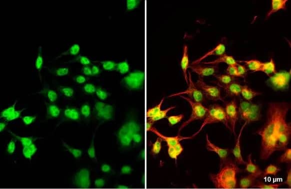 Immunocytochemistry/ Immunofluorescence: NKX2.5 Antibody [NBP1-31558] - NKX2.5 antibody detects NKX2.5 protein at nucleus by immunofluorescent analysis.Sample: 293T cells were fixed in 4% paraformaldehyde at RT for 15 min.Green: NKX2.5  stained by NKX2.5 antibody (NBP1-31558) diluted at 1:500.Red: alpha Tubulin, a cytoskeleton marker, stained by alpha Tubulin antibody [GT114]  diluted at 1:1000.