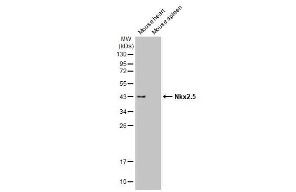 Western Blot: NKX2.5 Antibody [NBP1-31558] - Various tissue extracts (50 ug) were separated by 12% SDS-PAGE, and the membrane was blotted with NKX2.5 antibody (NBP1-31558) diluted at 1:1000. The HRP-conjugated anti-rabbit IgG antibody  was used to detect the primary antibody.