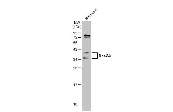 Western Blot: NKX2.5 Antibody [NBP1-31558] - Rat tissue extract (50 ug) was separated by 12% SDS-PAGE, and the membrane was blotted with NKX2.5 antibody (NBP1-31558) diluted at 1:1000. The HRP-conjugated anti-rabbit IgG antibody  was used to detect the primary antibody.