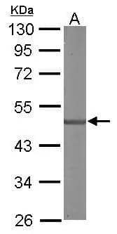Sample (50 ug of whole cell lysate)  A: mouse brain  10% SDS PAGE  NBP1-31567 diluted at 1:3000  