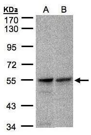 Sample(30 ug whole cell lysate)A:A431B:Raji 7.5% SDS PAGENBP1-31570 diluted at 1:1000 