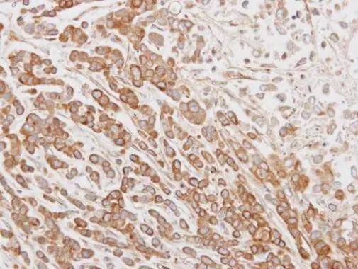 Immunohistochemical analysis of paraffin-embedded MDA-MB468 xenograft, using CABS1(NBP1-31573) antibody at 1:100 dilution. Antigen Retrieval: (EDTA based, pH 8.0) buffer, 15min 