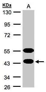 Sample(30 ug whole cell lysate)A:MOLT4 10% SDS PAGENBP1-31573 diluted at 1:1000 